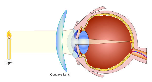 I went blind when Google stopped supporting my lenses